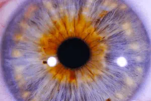 curso-iridologia-irisdiagnose-instituto3visao